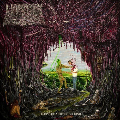 Undeath - Lesions Of A Different Kind [Slim Green Vinyl] (New Vinyl LP) - Mad World Records